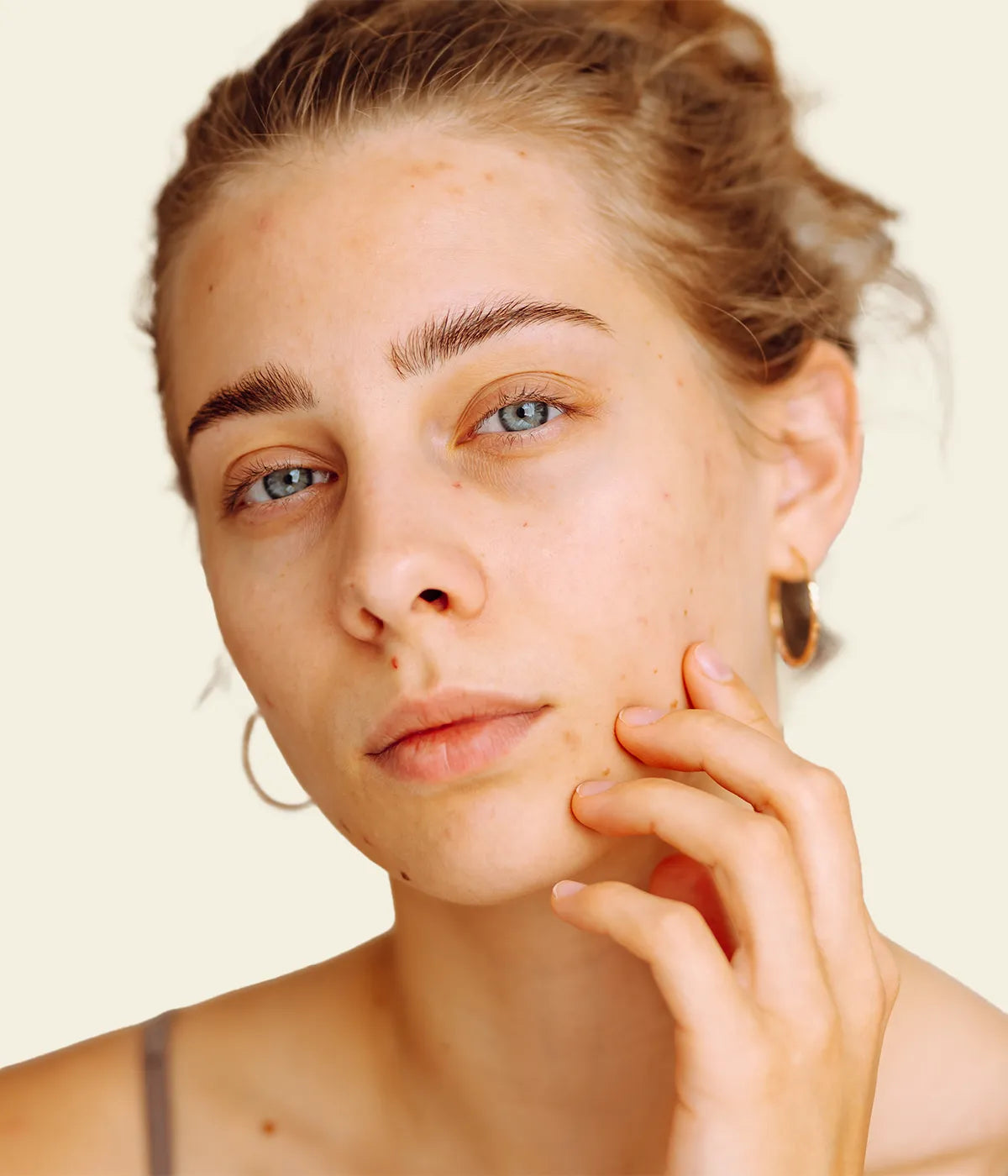 Best Natural Soap For Acne